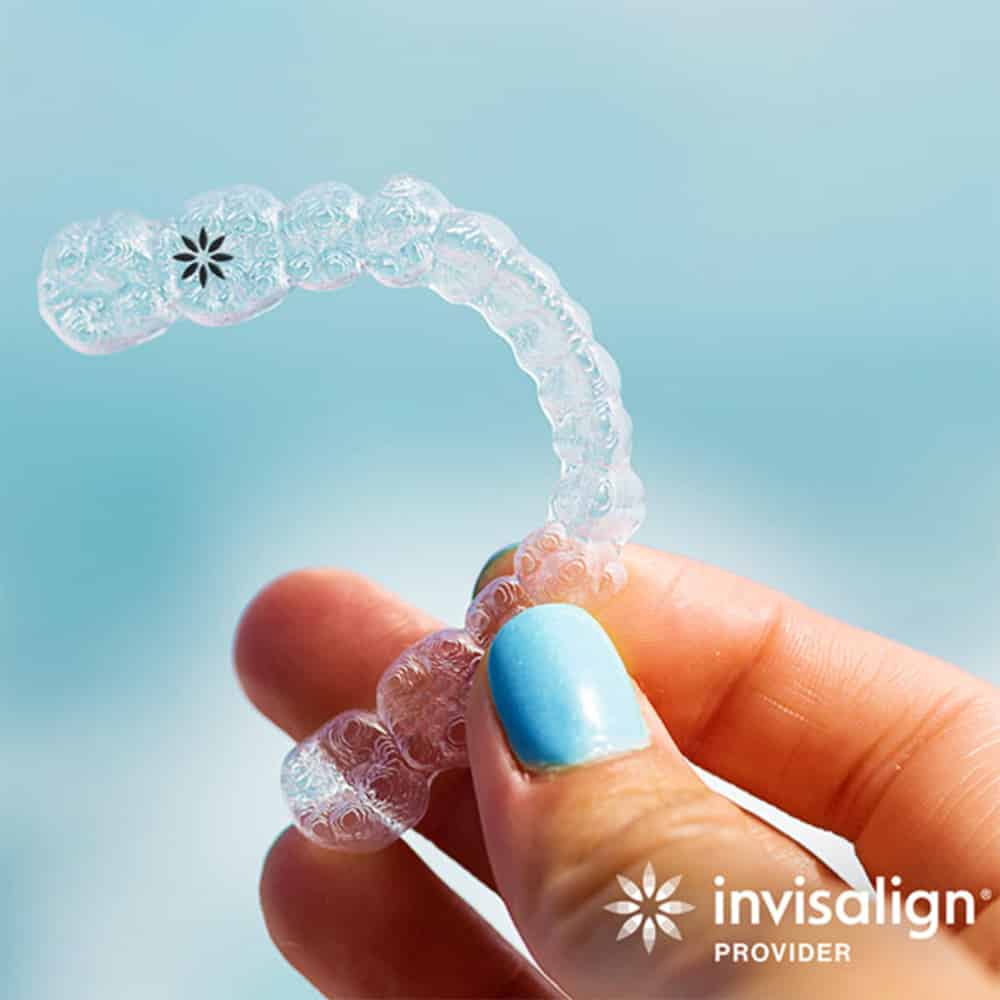 Invisalign Aligner Photo 1